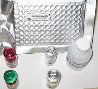 Human β-lactamase ELISA Kit Kit