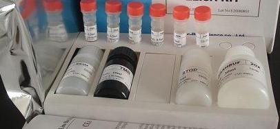 Rat Insulin,INS ELISA Kit