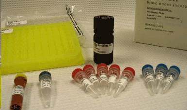 Rat acetylcholine receptor antibody,AChRab ELISA Kit